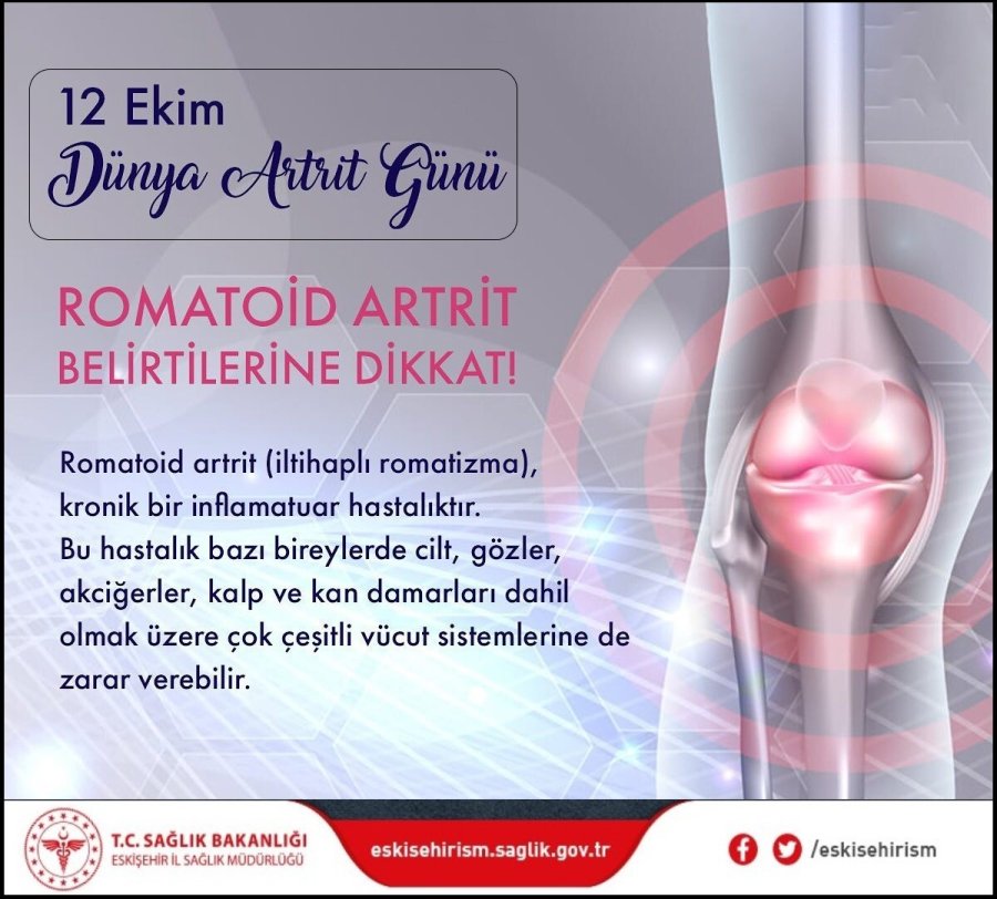 Bilge’den Dünya Artrit Günü Açıklaması