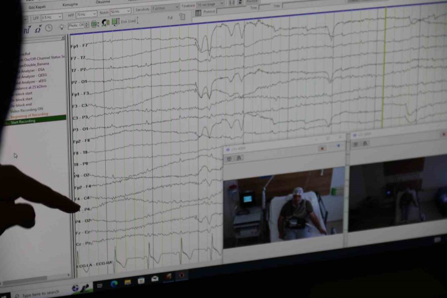 Beyindeki Hasarları Tespit Eden Cihaz Eskişehir Şehir Hastanesi’nde Hizmete Alındı